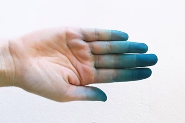 Tangan terkena tinta biru